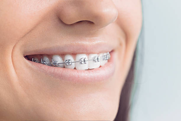 Best Wisdom Tooth Removal  in Brown Deer, WI
